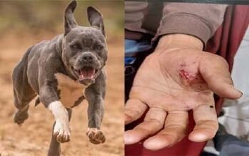 मथुरा में बुलडॉग ने किया मजदूर युवक पर जानलेवा हमला