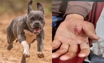 मथुरा में बुलडॉग ने किया मजदूर युवक पर जानलेवा हमला